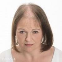 niechirurgiczne uzupełnianie włosów,włosy słowiańskie , Dorota Olejniczak