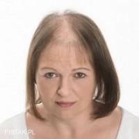 niechirurgiczne uzupełnianie włosów , Dorota Olejniczak